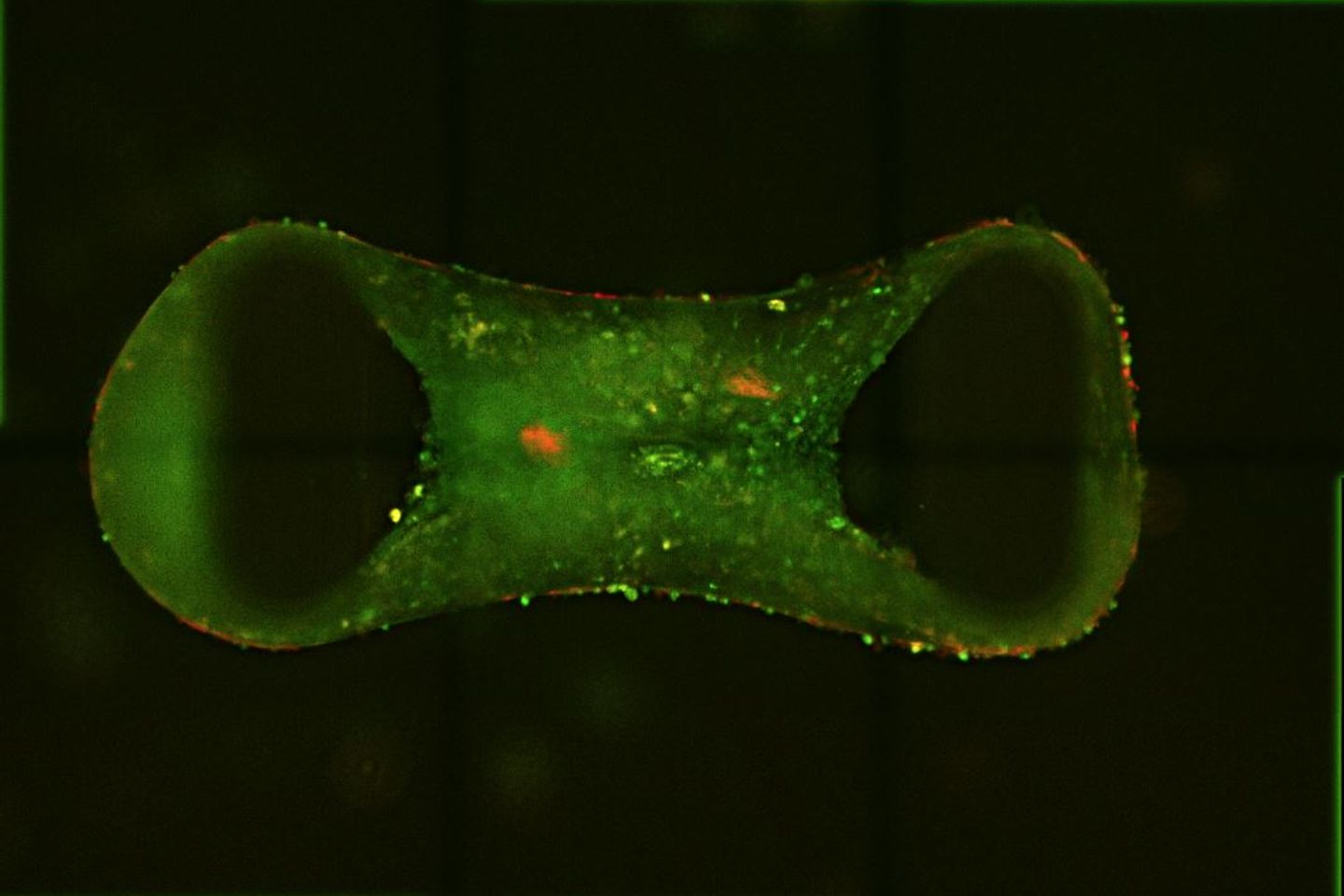 Lab-grown ‘tiny hearts’ bring hope for children and adults 
with genetic heart disease
