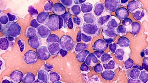 Blood cancer cells