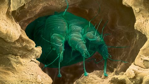 A scabies mite