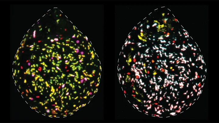 After surgery, tumour tissue is cut into small pieces (~0.5 mm) and cultured for ~1 week. Using these organoids, we investigate how the proportion of quiescent/‘sleeping’ glioblastoma stem cells changes in response to various drug treatments. This information is invaluable in directing us in our mission to improve current treatment strategies for glioblastoma. Abundance of quiescent glioblastoma stem cells (green) and actively-dividing glioblastoma stem cells (magenta). Red cells are non-stem cells.