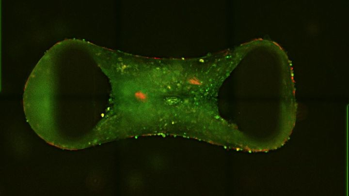 Lab-grown ‘tiny hearts’ bring hope for children and adults 
with genetic heart disease
