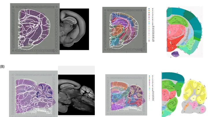 spatial mapping of the brain