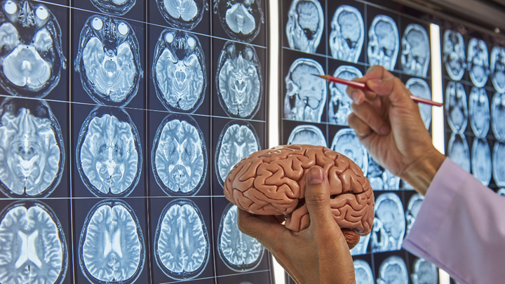 Brain structure and neurodegeneration